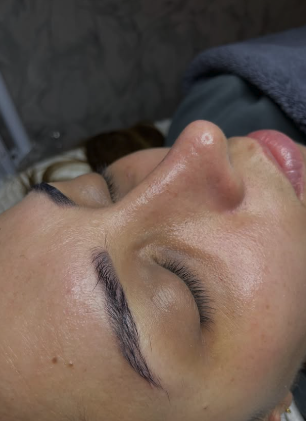 Antalya Lara’da Cilt Bakımı Neden Düzenli Yapılmalı?